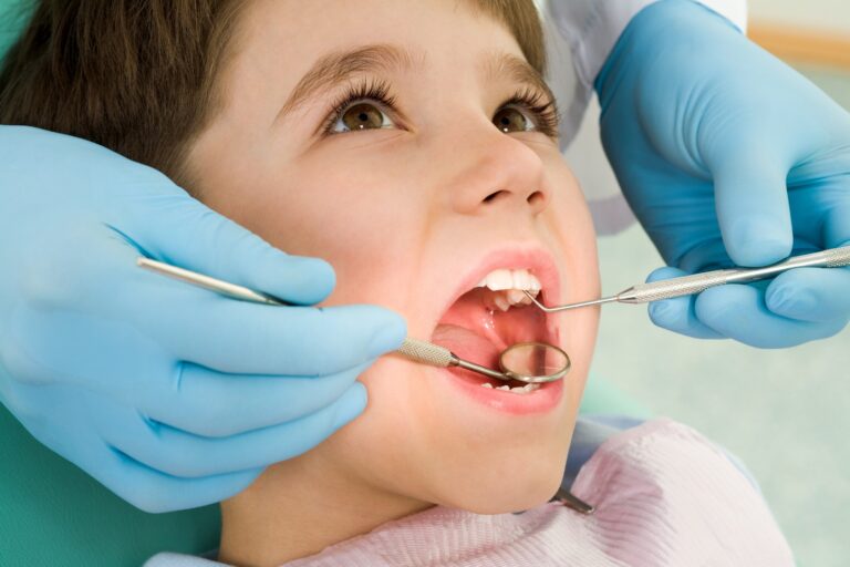 How to Treat Cavities in Baby Teeth Naturally